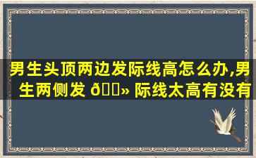 男生头顶两边发际线高怎么办,男生两侧发 🌻 际线太高有没有 🐕 好办法
